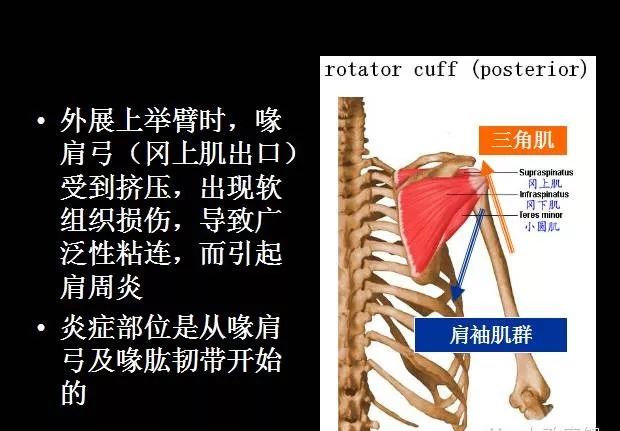 另外肩胛骨的回缩肌群收缩也使得盂肱关节间隙变大,同样有助于增大冈