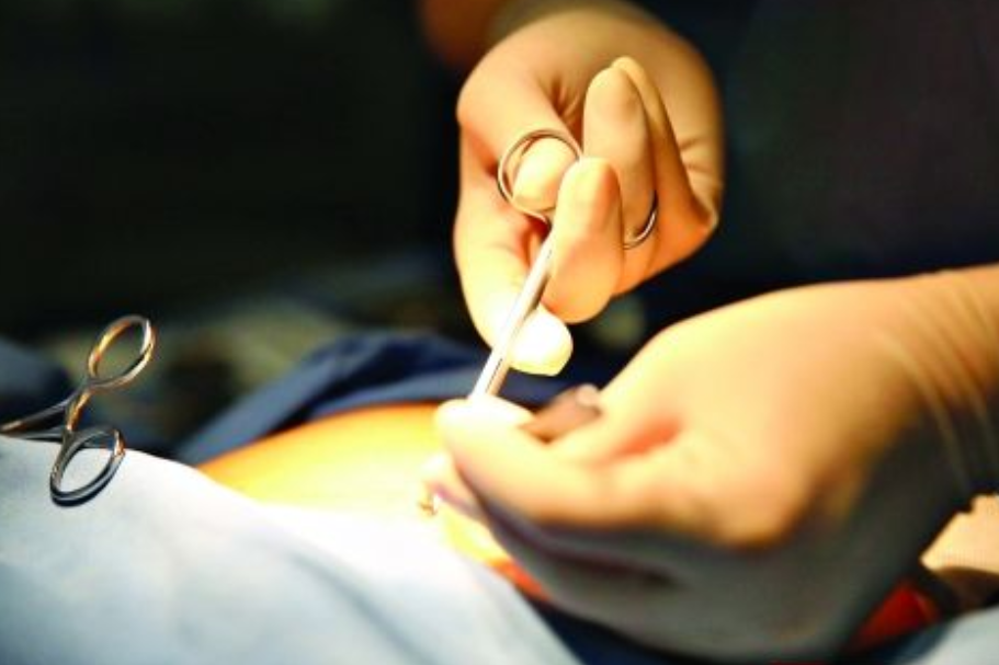 因为每个人的身体情况不同,有很多人刚做完结扎手术,输精管也有可能是