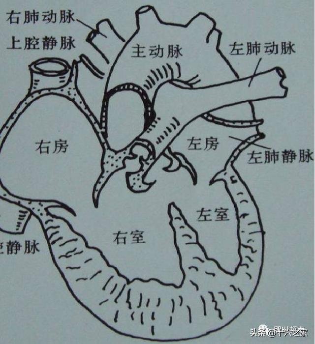 三血管气管切面异常图片