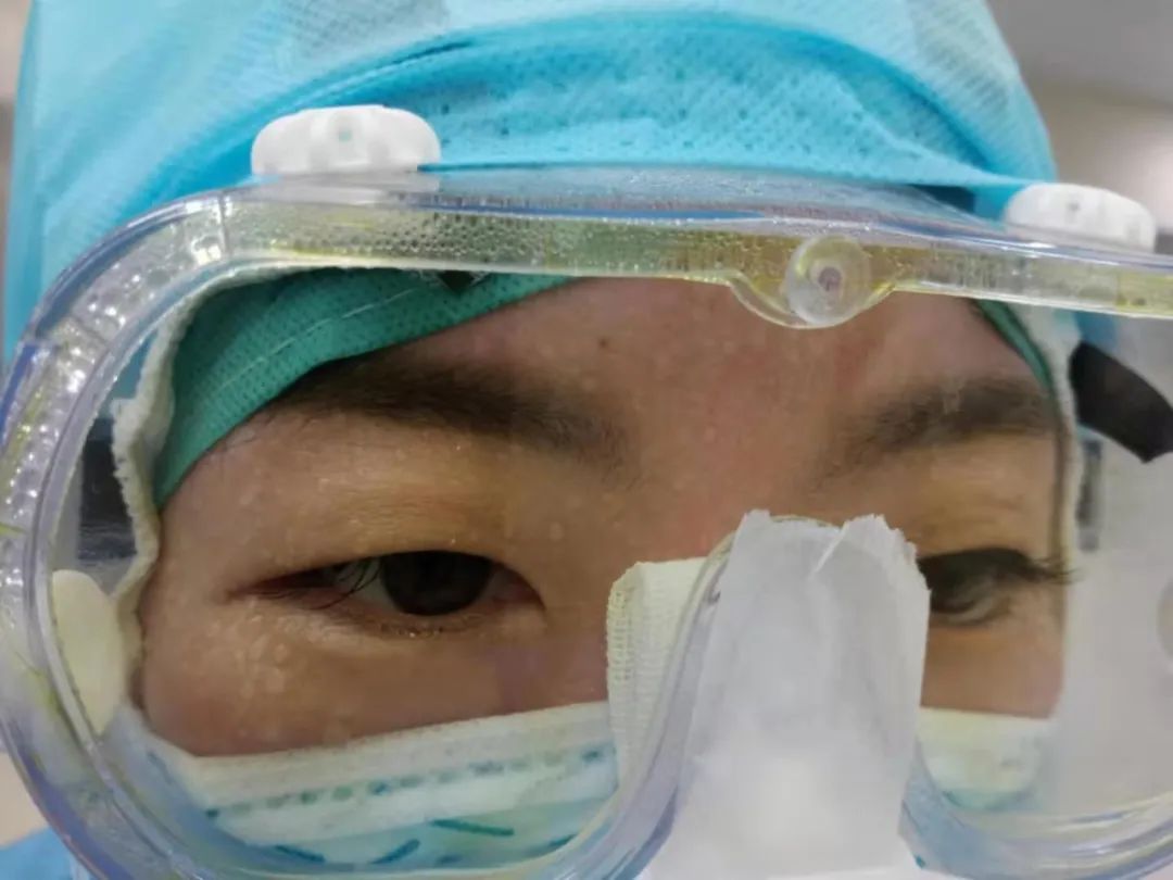 一线医护日记工作到一半早已满脸汗水衣襟湿透