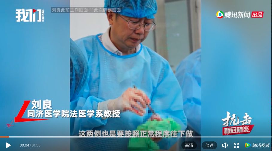 3例新冠肺炎逝者遗体解剖报告将公布,法医透露手术细节_刘良