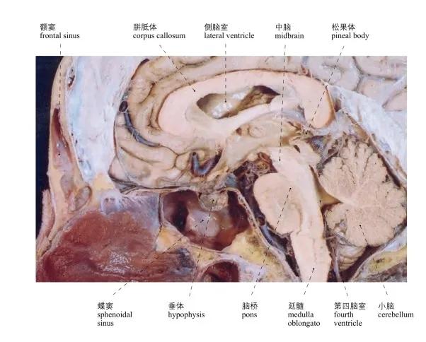 頭部局部解剖學圖譜_the