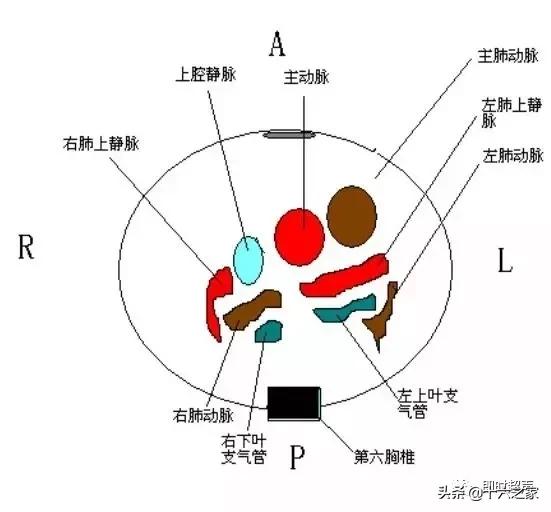 胎儿心脏三血管切面详解