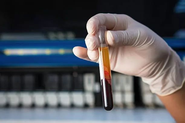 血稠就是高血脂输液能通血管别再被骗了关于血液的5个真相你需知道