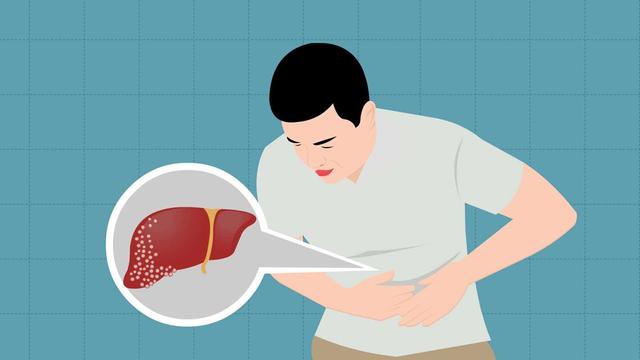 肝变硬之前并非毫无征兆,多半会出现4个变化,不妨对照一下