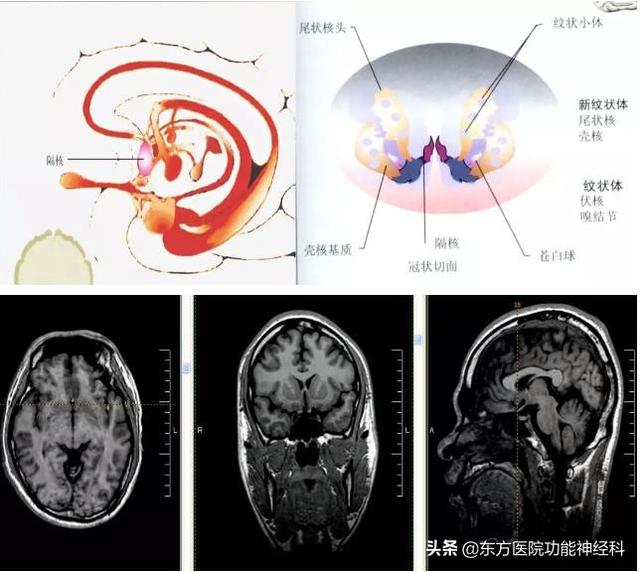 (二)隔核及其纖維聯繫(一)海馬結構解剖海馬結構位於人腦邊緣葉深部