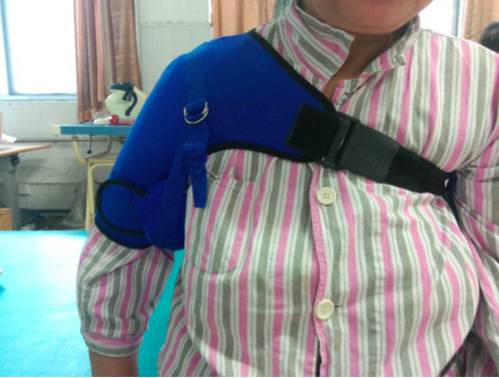 偏瘫后肩关节半脱位的预防和治疗