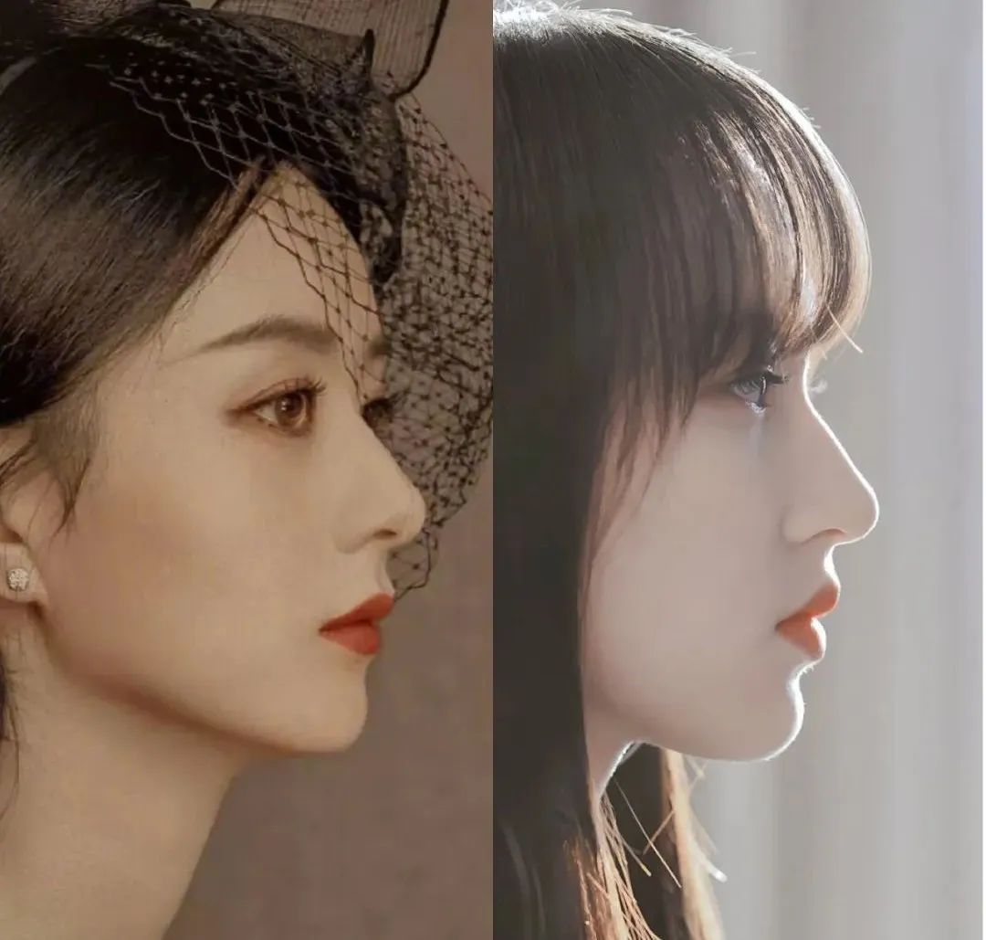 鼻子最好的比例是这样的:鼻额角120-130°,鼻唇角90-95°,千万别做成