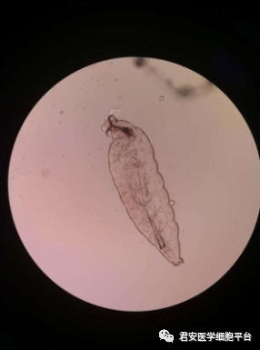 名家讲坛一不小心入了你的眼眼部羊狂蝇感染
