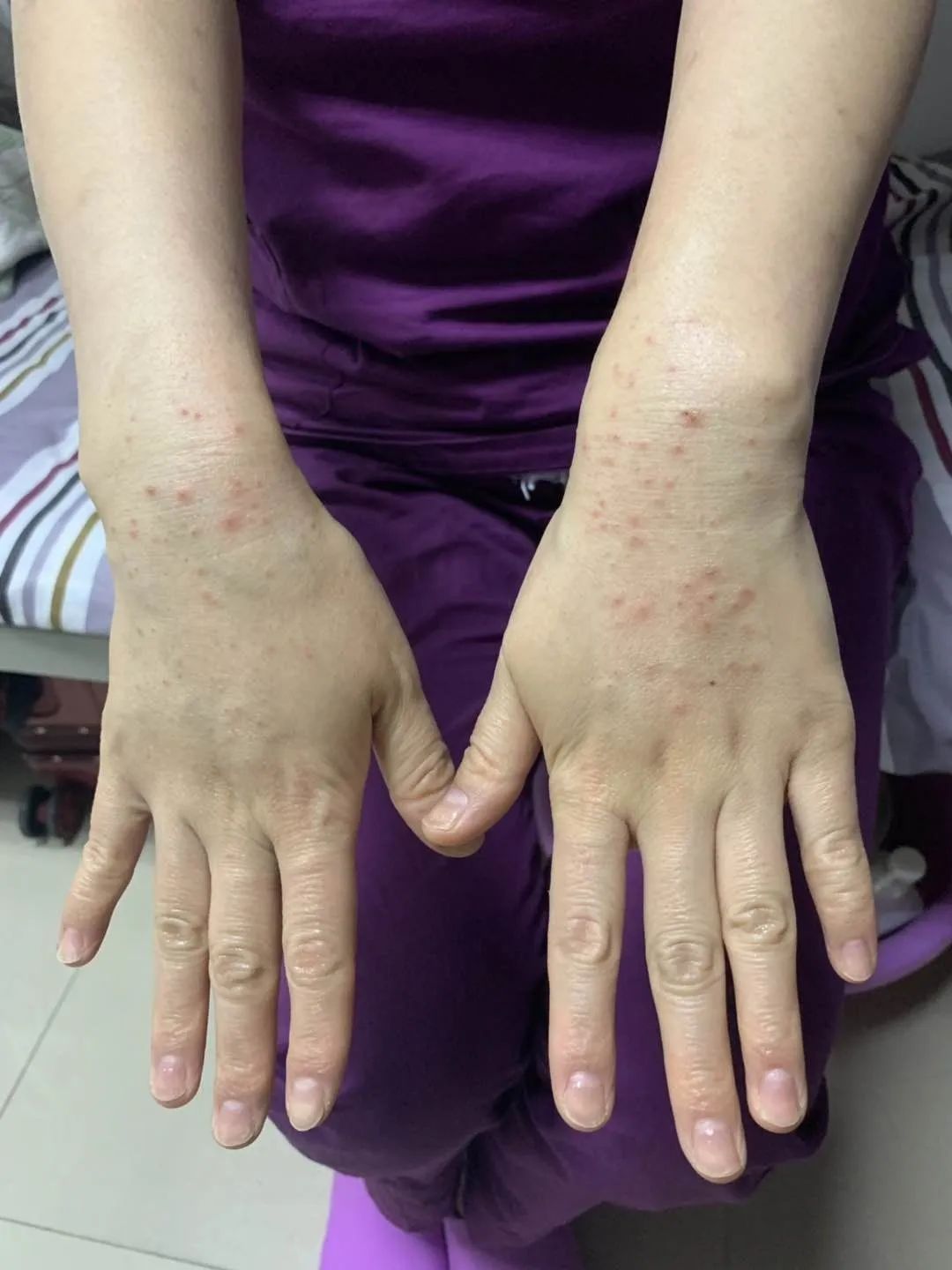 你的样子 我的"疫"线战友 致敬我院支援市第二医院的医护人员_丁雪