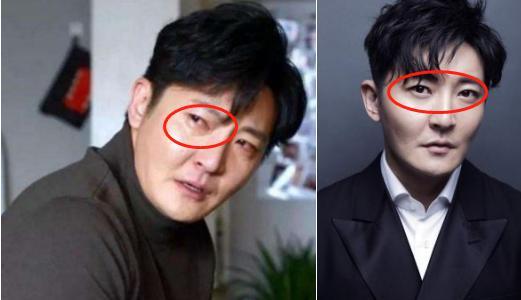 不仅郭京飞,就连靠才华吃饭的马东也去割了眼袋,在《奇葩说》的现场