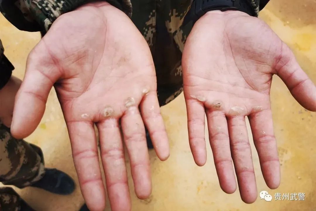 "的背后,是战士们拼搏的汗水,他们摸爬滚打,奋力拼搏,手上的"茧"也