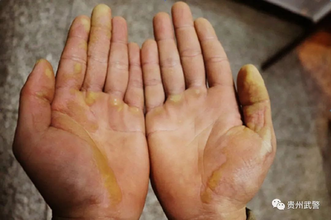 这是每名战士特有的军功章