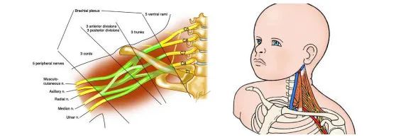 产科难题肩难产的处理分步骤多图片讲解耸肩法的应用