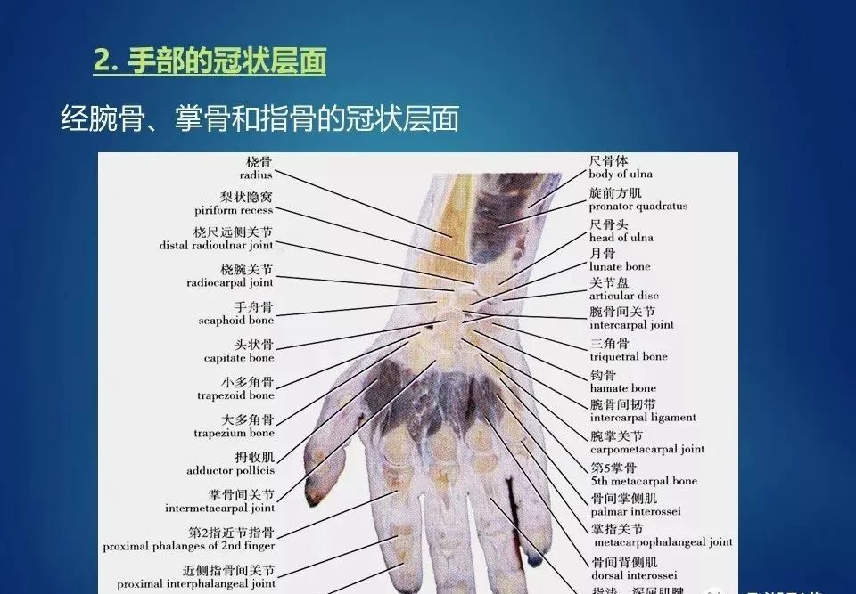 上肢断层解剖及影像