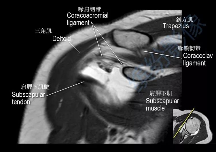 肱骨ct断层解剖图片