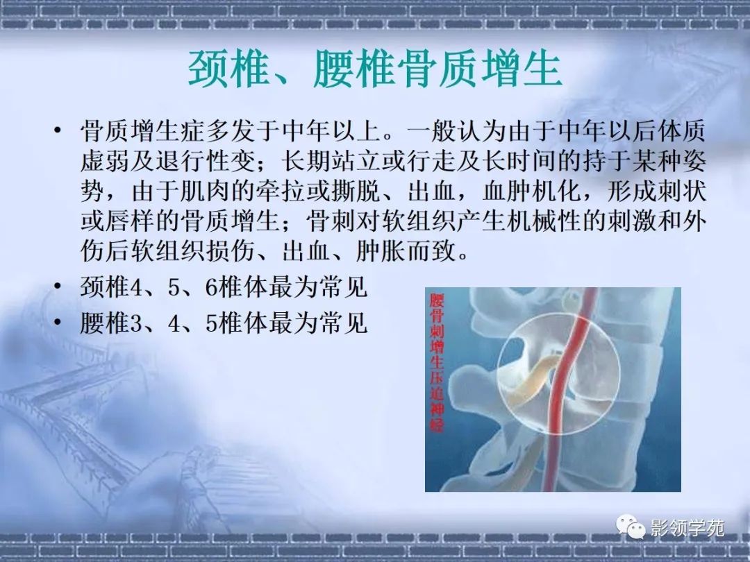 颈椎腰椎ct常见病变