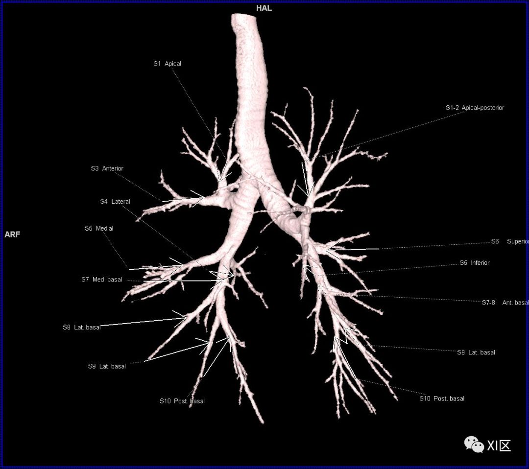 段支氣管的命名氣管樹的動態觀察視頻肺的分段肺的分段示意圖(圖片源