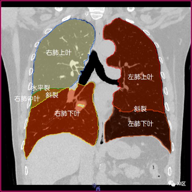 如此详细的肺部影像解剖有点儿酷