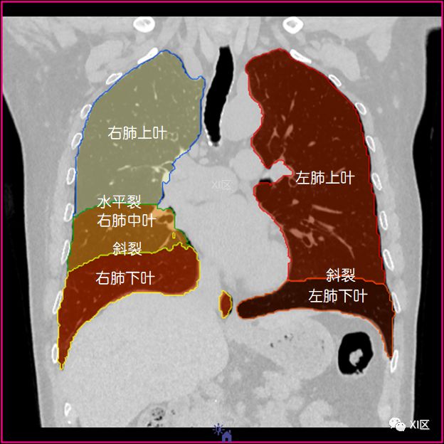 左肺下叶各段位置图图片