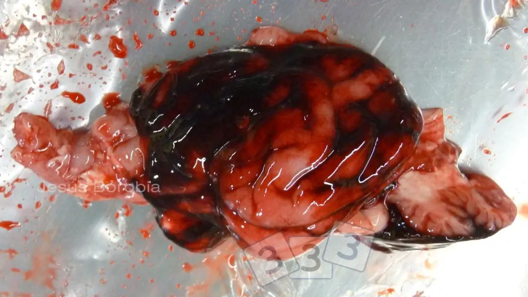 一头仔猪的大脑在尸检时可见出血.这是什么病变?