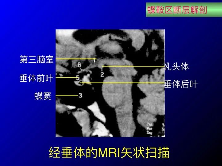 鞍区解剖图MRI图片