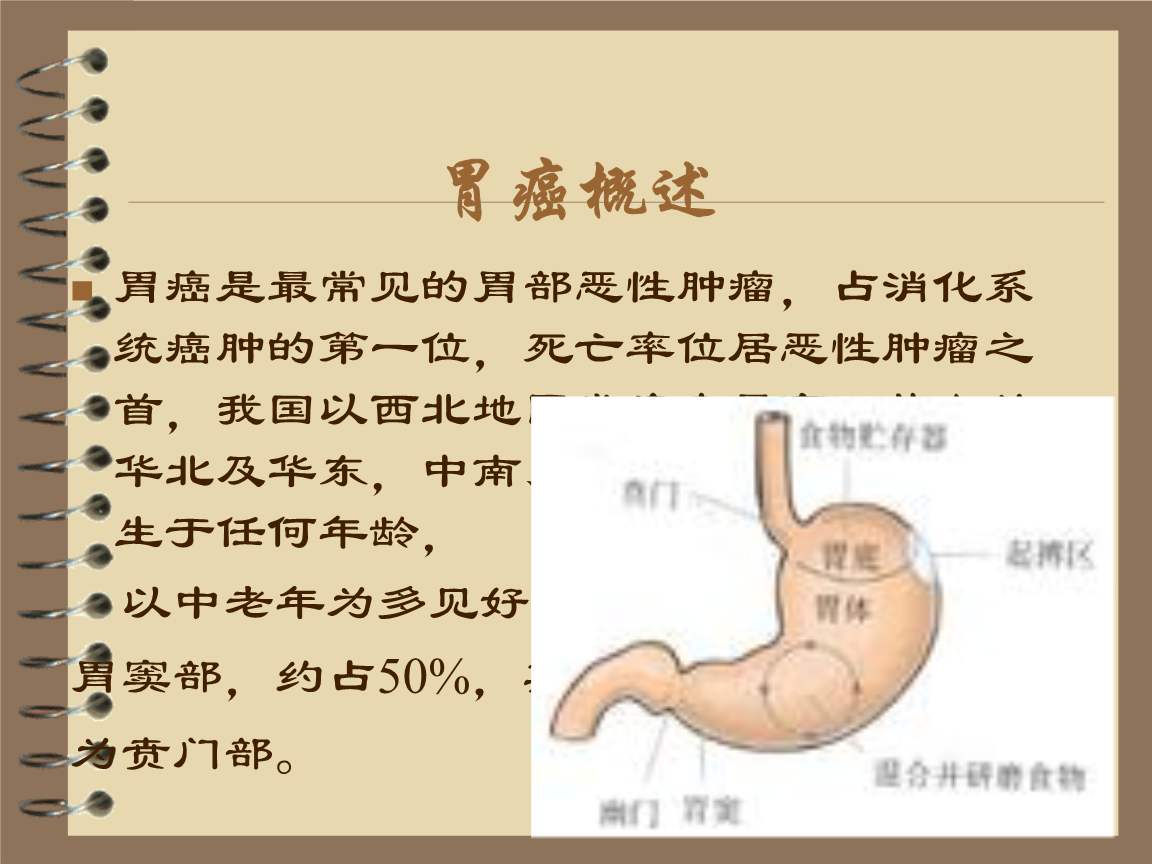 晚期胃癌是如何治疗的