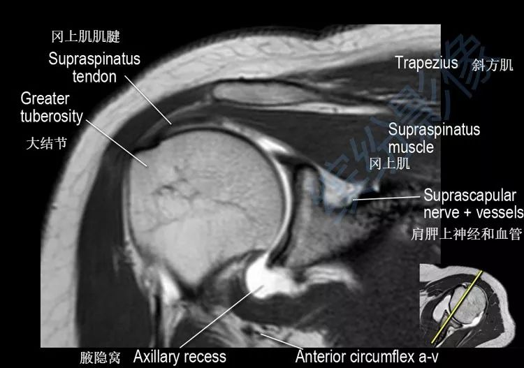 greater tuberosity图片