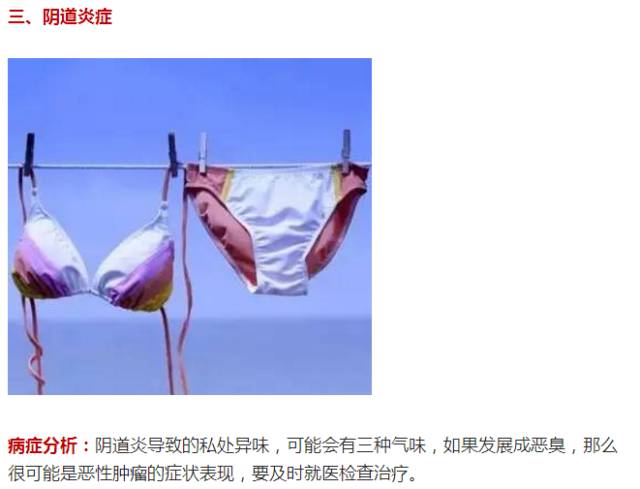 为什么阴道会有味道 为什么阴道会有味道