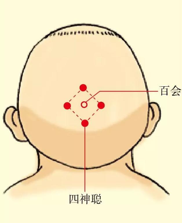 神经内科经常头痛的话按摩头部穴位有效缓解