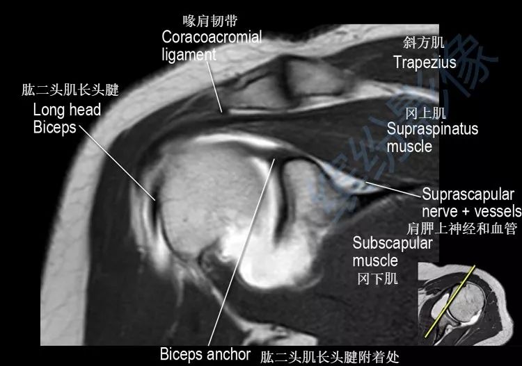 肩关节斜冠状面mr断层解剖