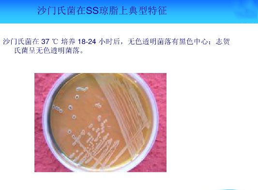 资料常见微生物菌落形态