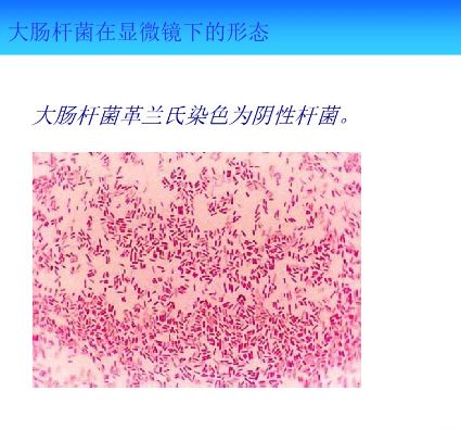 资料常见微生物菌落形态
