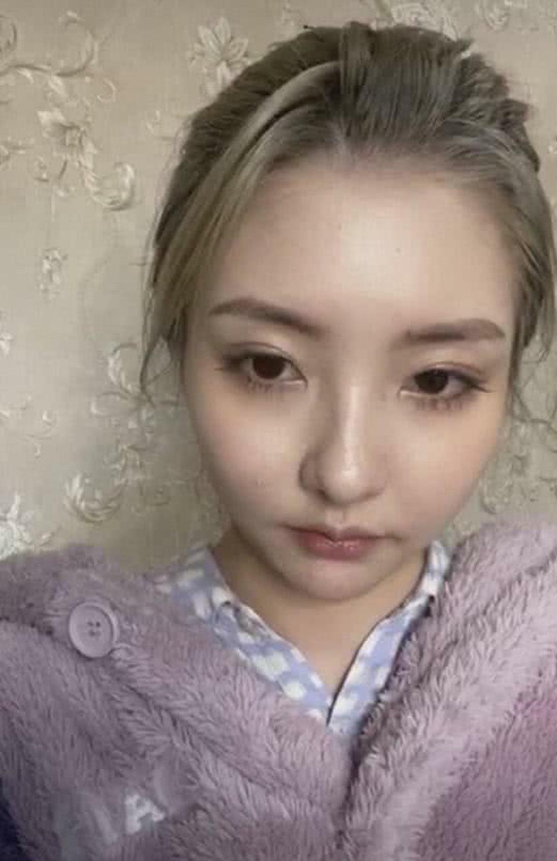 王思聪前女友豆得儿近照曝光无滤镜面部肿胀显老