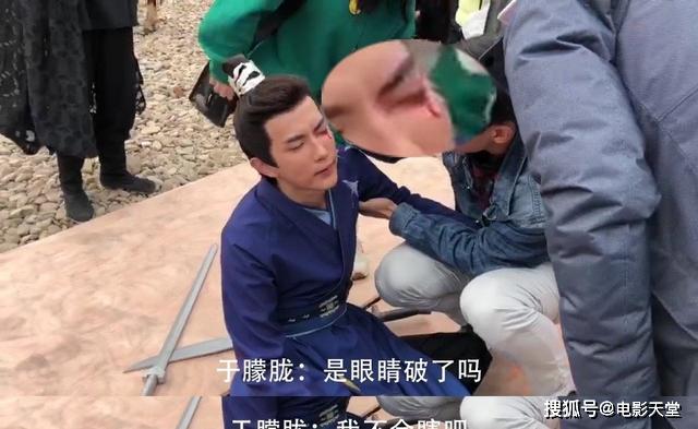 原创于朦胧回应拍戏受伤眼睛流血无大碍曾因拍戏摔成五处骨折