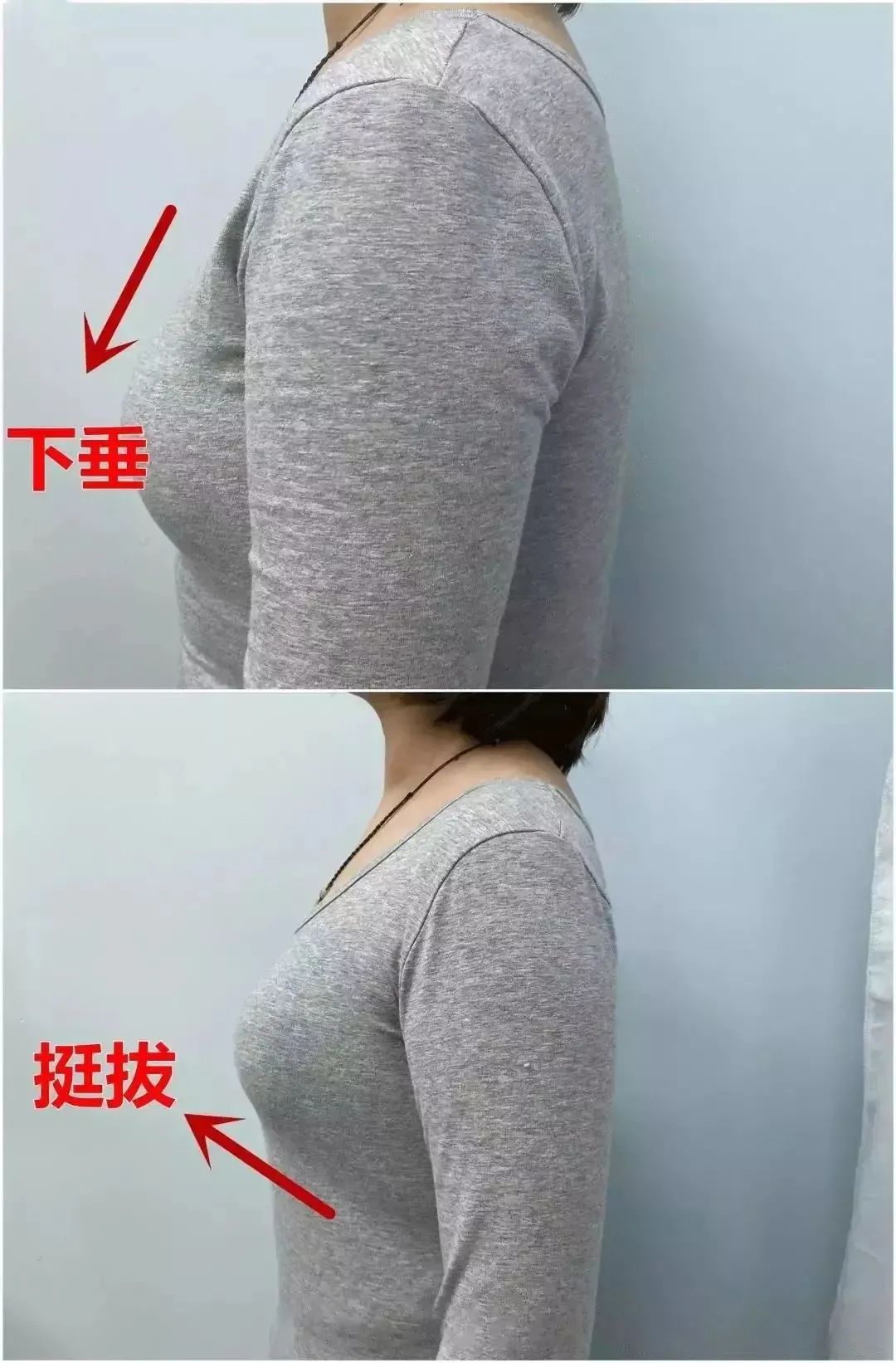 胸外扩图片下垂正常图片