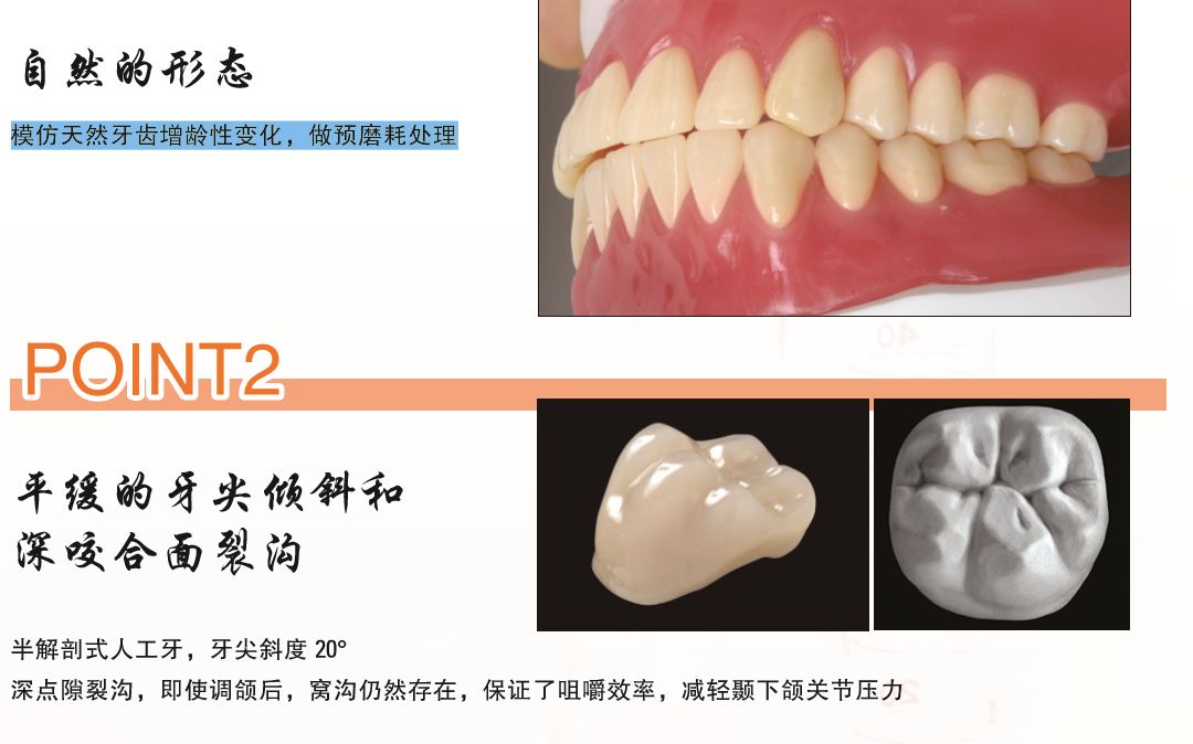 对于牙槽嵴水平条件不好的患者,我们还是建议选择半解剖的人工牙,即对