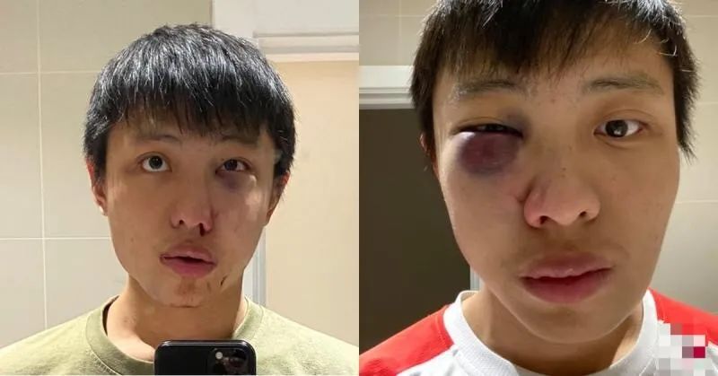 海外党被歧视事件频传,这还是文明社会么?