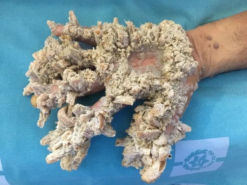 ①戳穿锂电池②长鼻象③按摩鳄鱼④套牛费手⑤飞机森林起飞⑥怪异事故