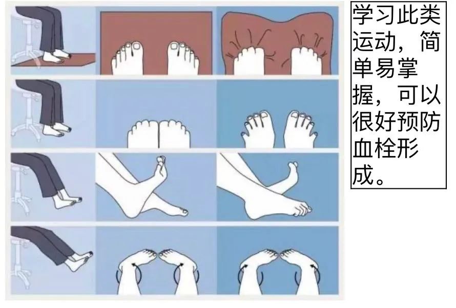 孕妇课题居家隔离也要动起来端州妇幼专家支招如何预防静脉血栓