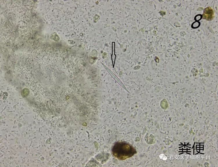 夏科雷登结晶图片