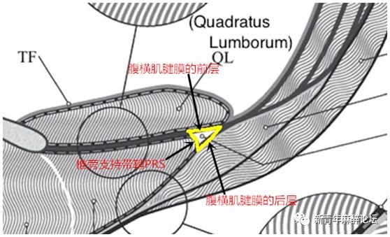 腰筋膜的中层mlf由3种不同的结构组成:1这条虚线表示腰方肌的封套筋膜