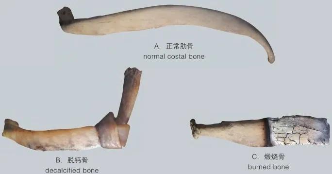 运动系统骨详解