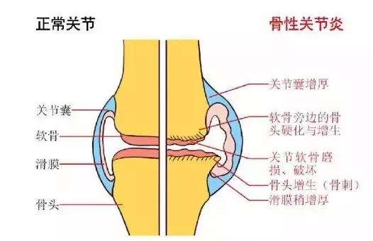 8种保护方法为膝关节减压,避免疼痛折磨_膝盖