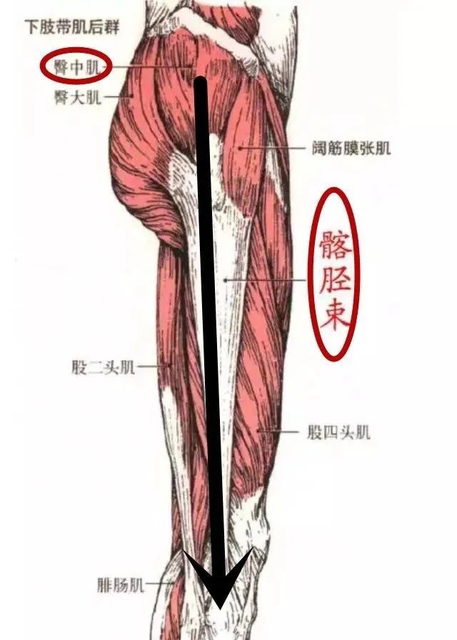 髂胫束滑囊位置图片