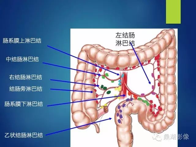 腹膜后淋巴结位置图图片
