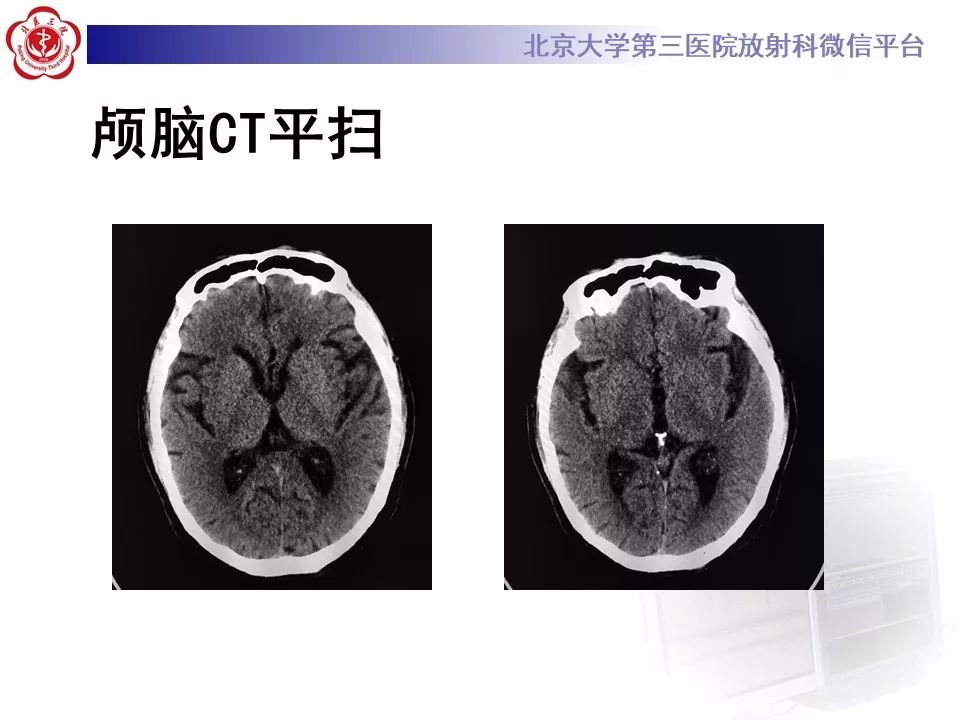 每日一例1027神经五官