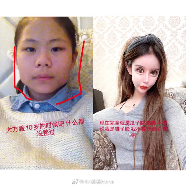 原创13岁整容3年60次变蛇精脸被喷像鬼她妈妈却这么说