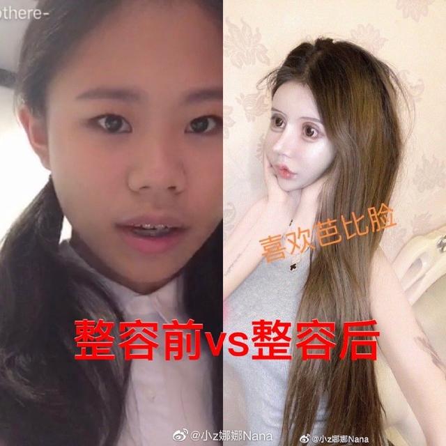原创13岁整容3年60次变蛇精脸被喷像鬼她妈妈却这么说