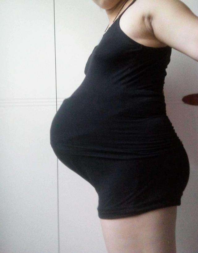 孕妇悬垂腹图片